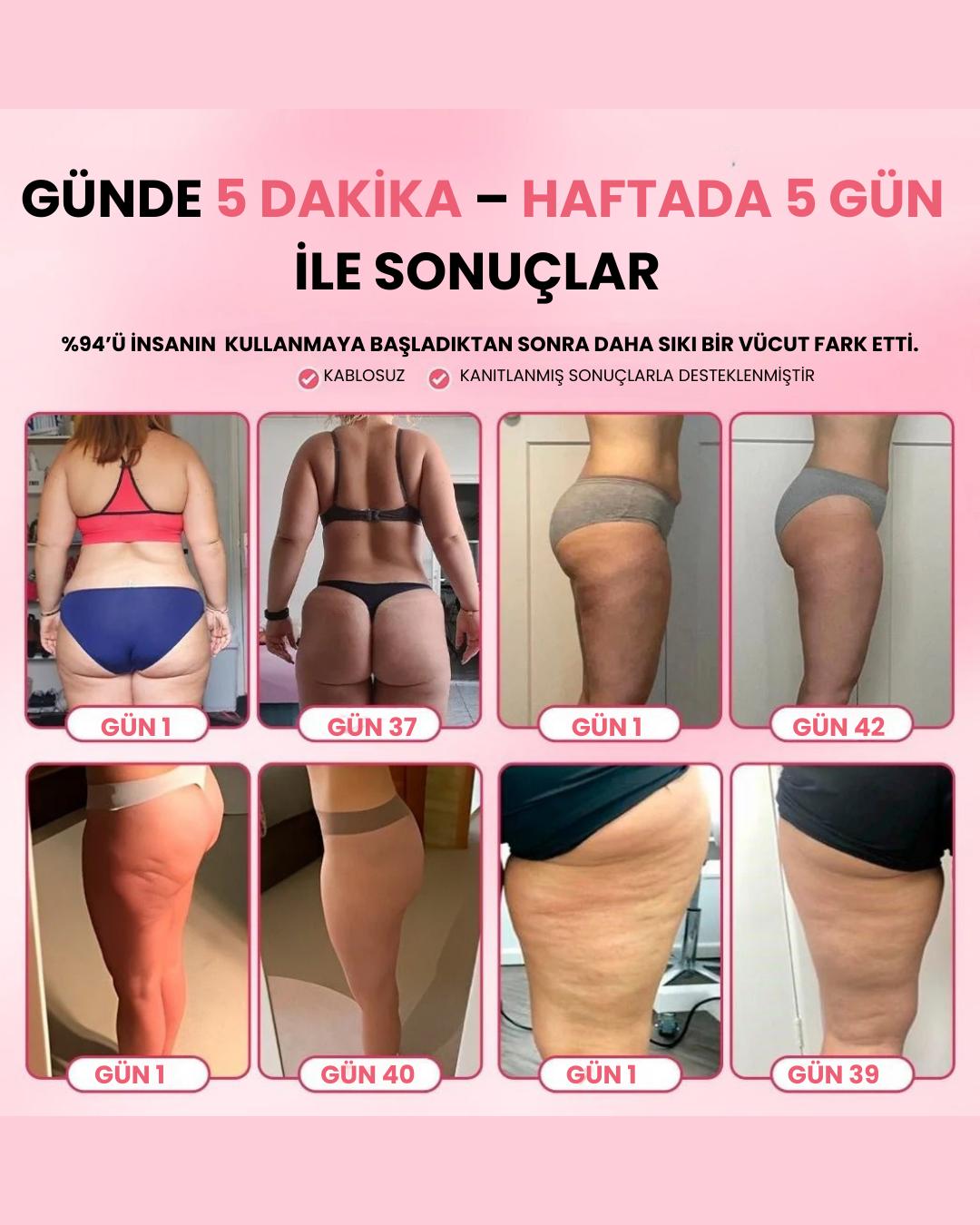 DermaLux™ Vakumlu Sıkılaştırıcı ve Selülit Giderici Vücut Masaj Aleti